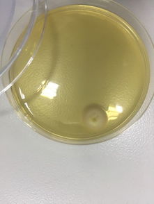 霉菌與食品微生物檢測 Discuz技術平臺在微生物檢測中的應用與前景