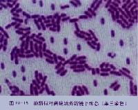 食品微生物檢驗(yàn) 守護(hù)餐桌安全的關(guān)鍵技術(shù)
